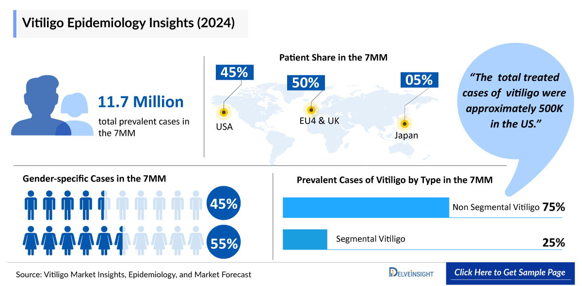 Vitiligo Epidemiology