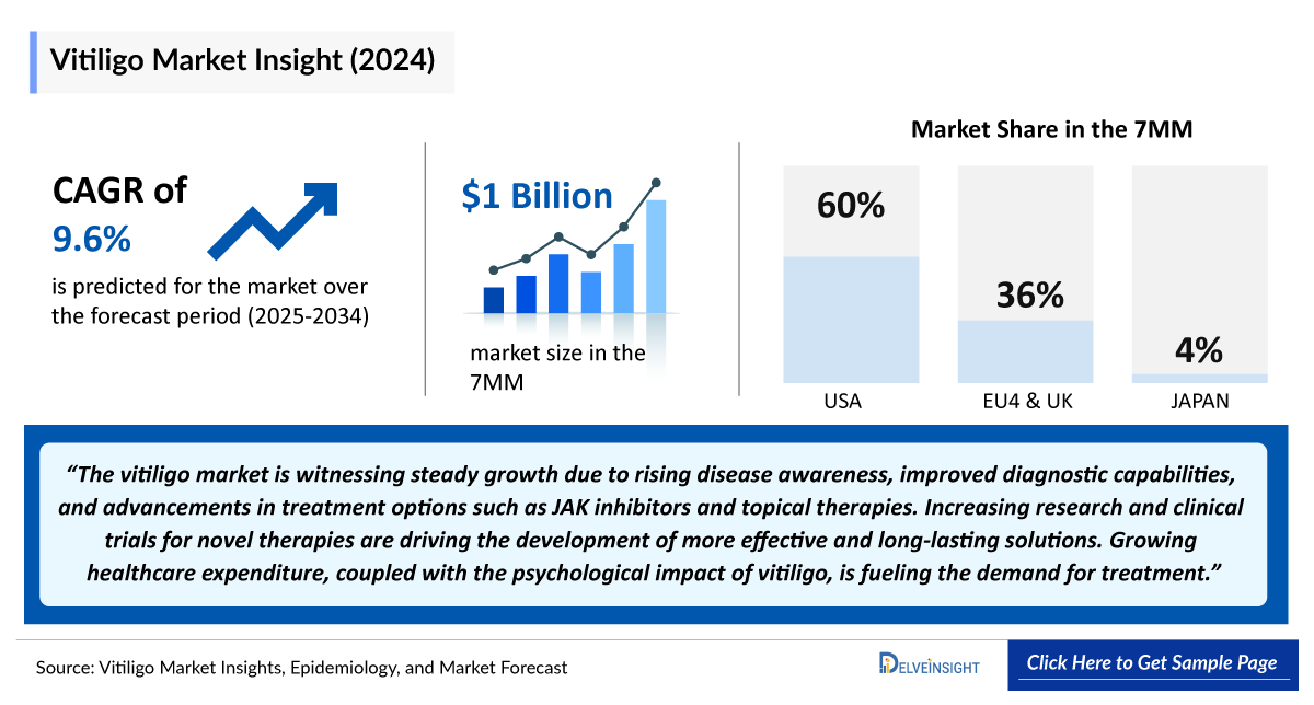 Vitiligo Market Outlook
