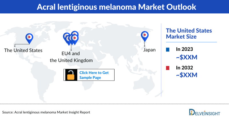 Acral lentiginous melanoma market outlook