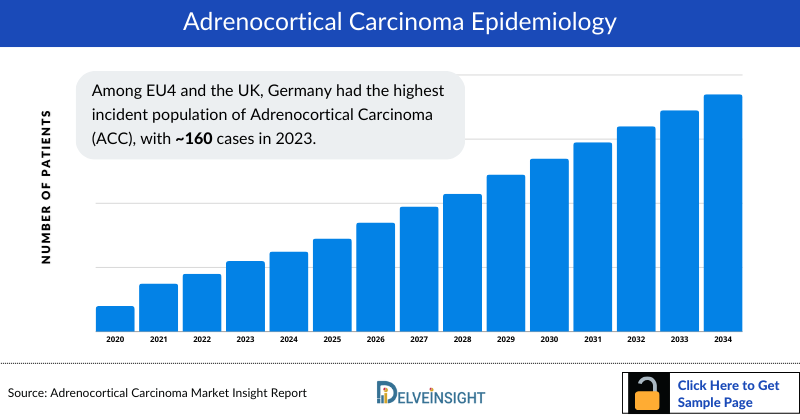 Adrenocortical Carcinoma Epidemiology 