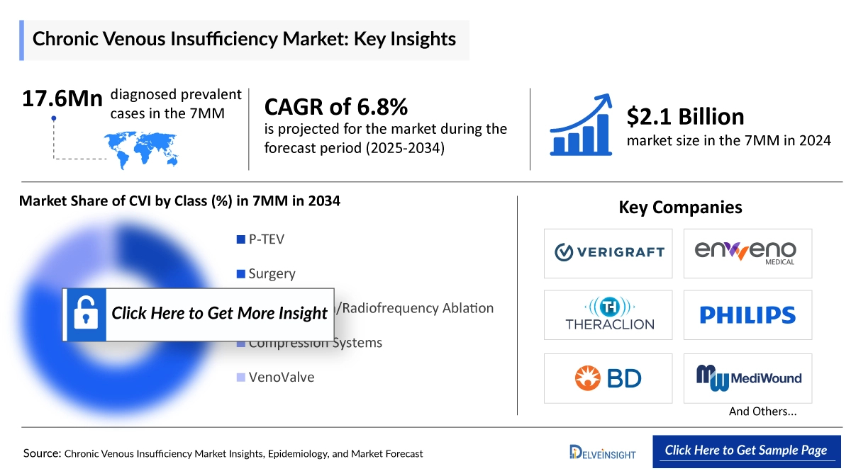 Chronic Venous Insufficiency Market Insight