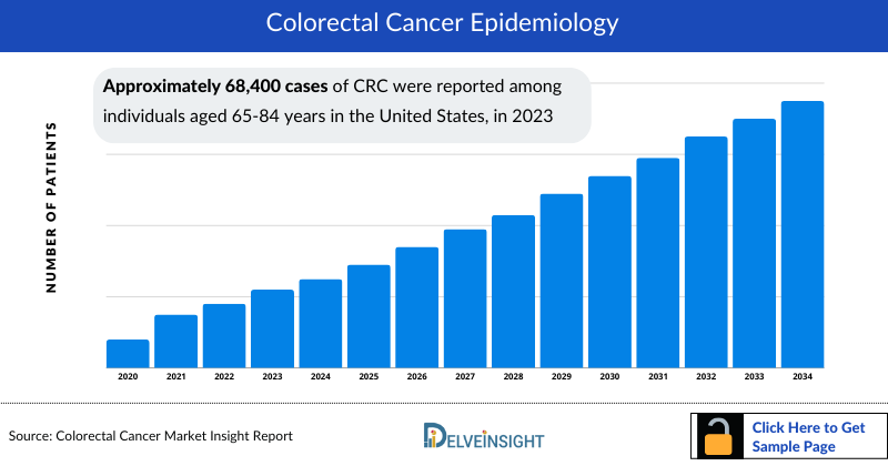 Colorectal Cancer Epidemiology