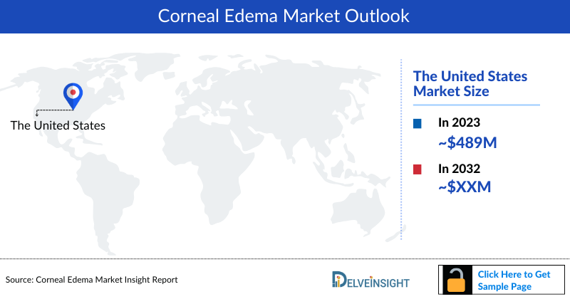 Corneal Edema Market Outlook