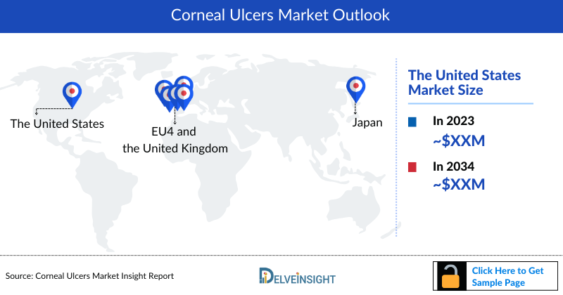 Corneal Ulcer Market Outlook