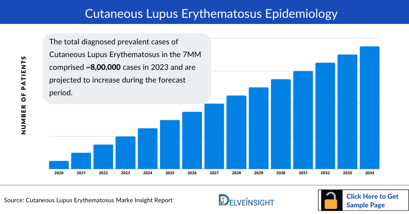 Cutaneous Lupus Erythematosus Epidemiology
