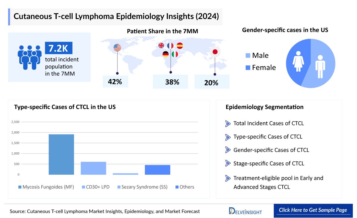 Cutaneous T-cell Lymphoma (CTCL) Epidemiology Insights