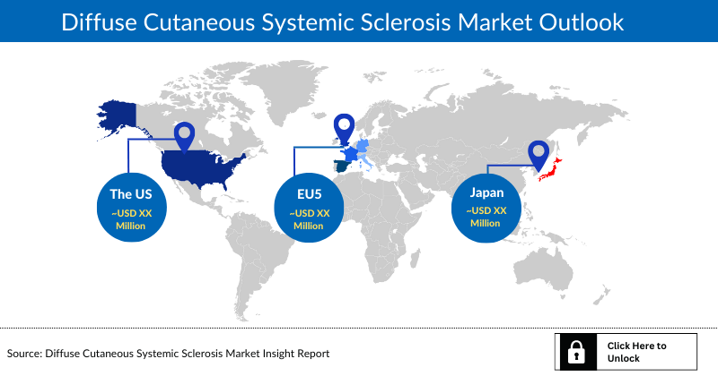 Diffuse Cutaneous Systemic Sclerosis Market Outlook