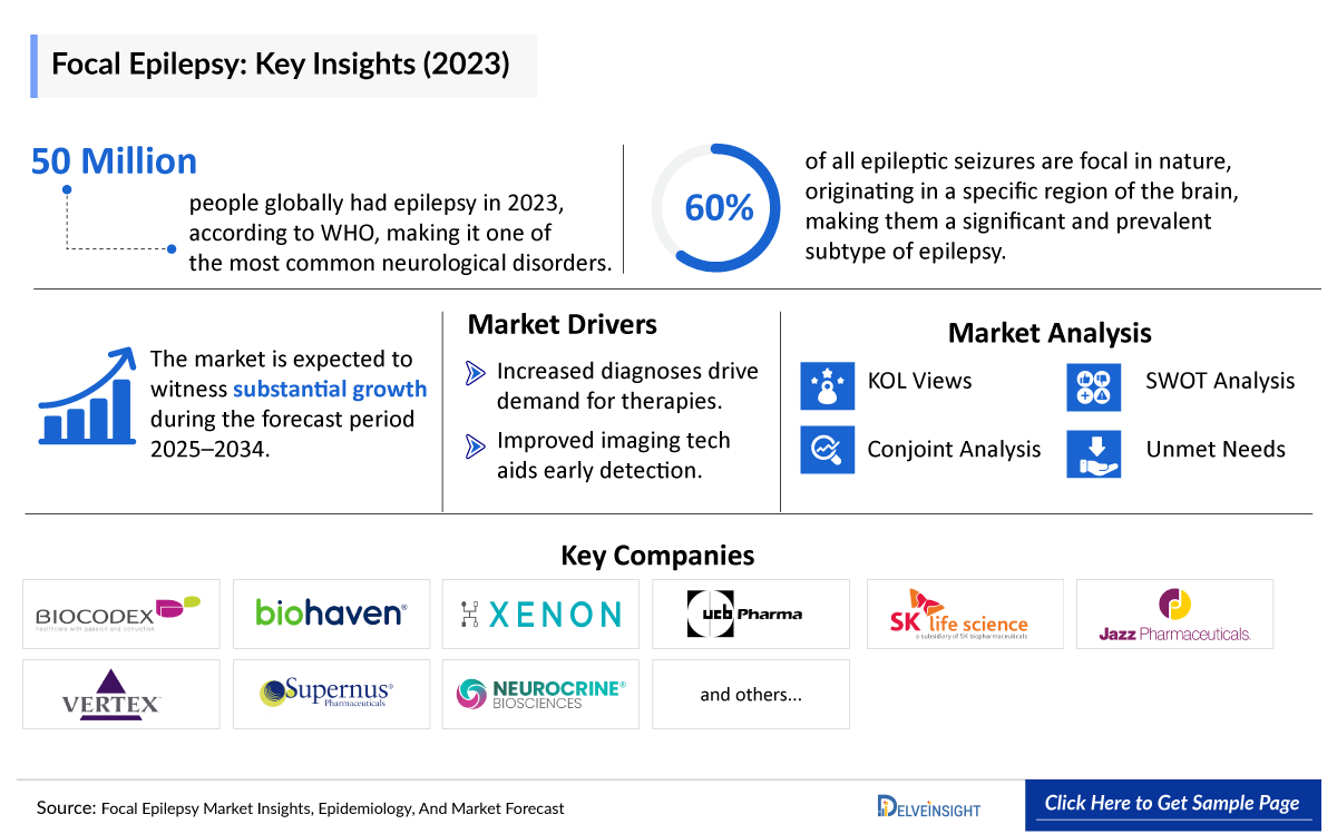 Focal Epilepsy Market Insights