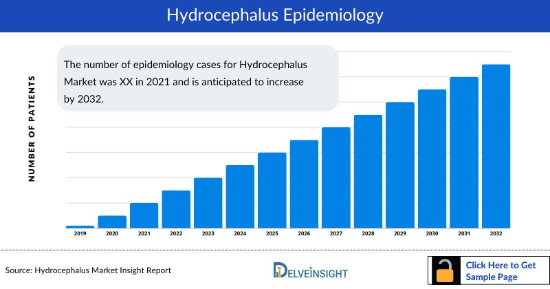Hydrocephalus Epidemiology