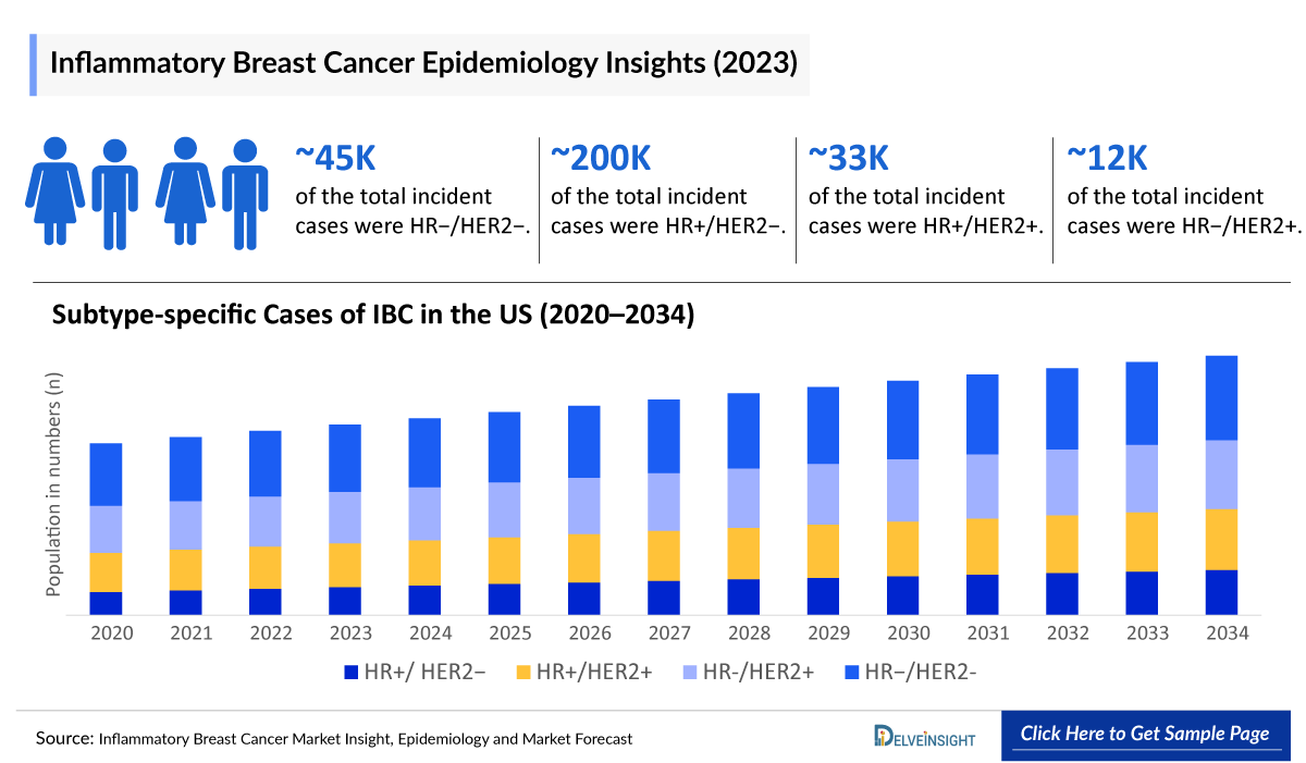 Inflammatory Breast Cancer Epidemiology Insight