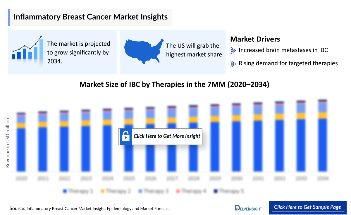 Inflammatory Breast Cancer Outlook