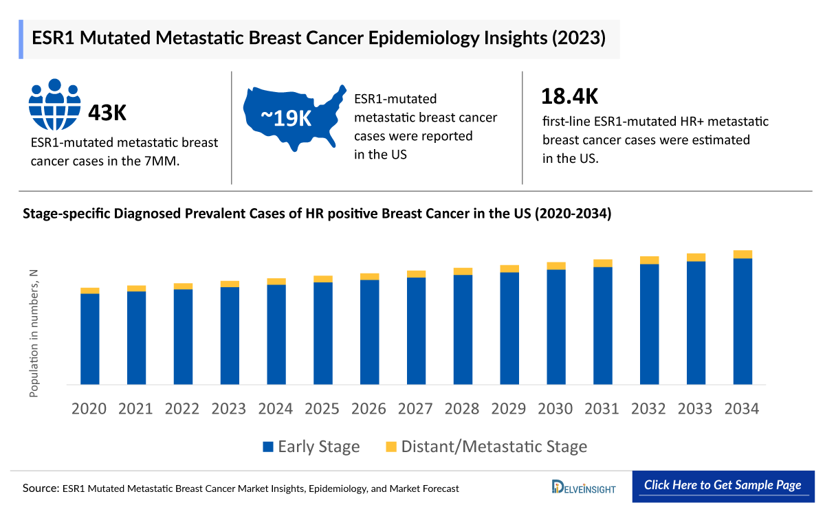 ESR1 Mutated Metastatic Breast Cancer Epidemiology Insight