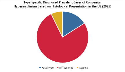 Congenital Hyperinsulinism Epidemiology