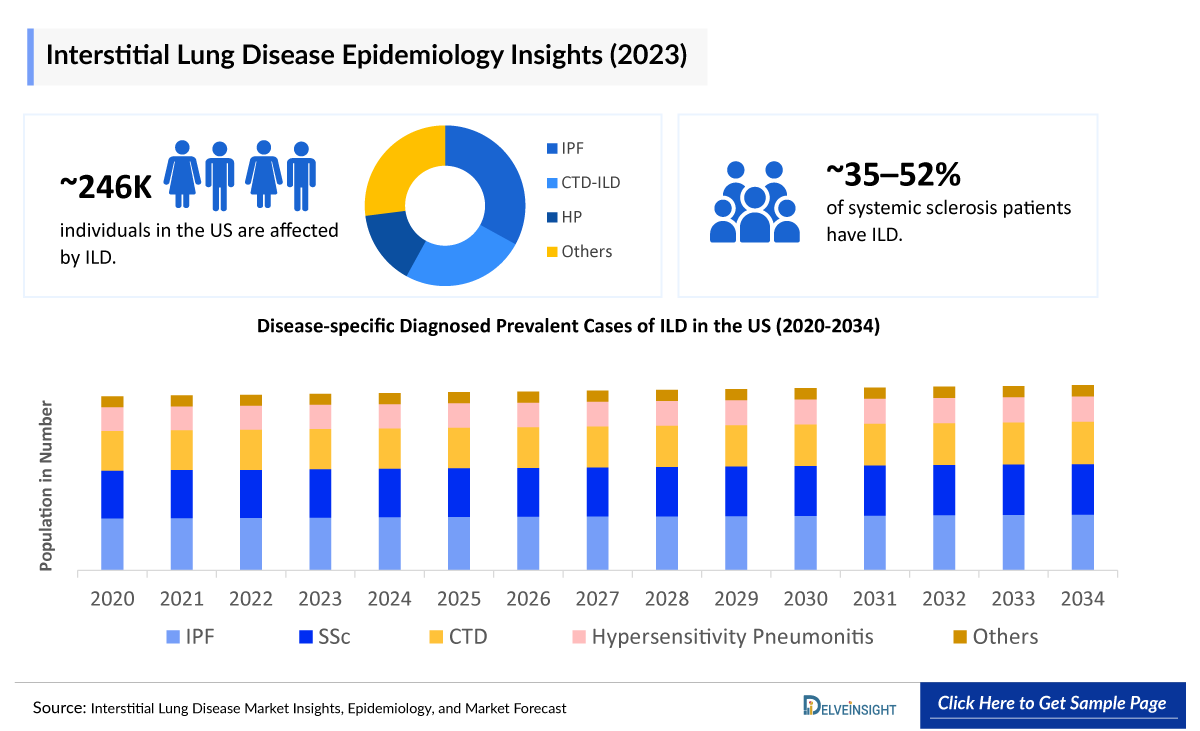 Interstitial Lung Disease Epidemiology Insight