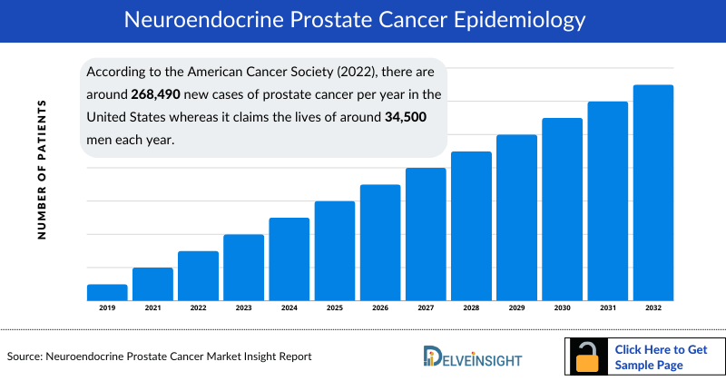 Neuroendocrine Prostate Cancer Epidemiology