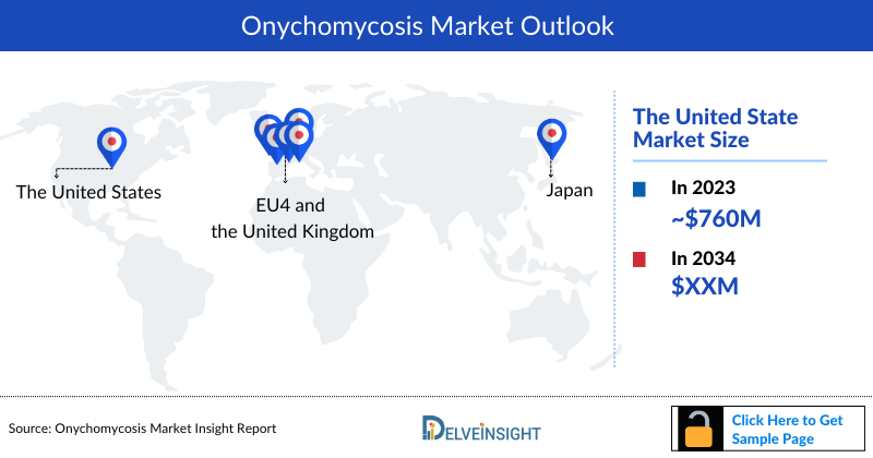 Onychomycosis Market Outlook