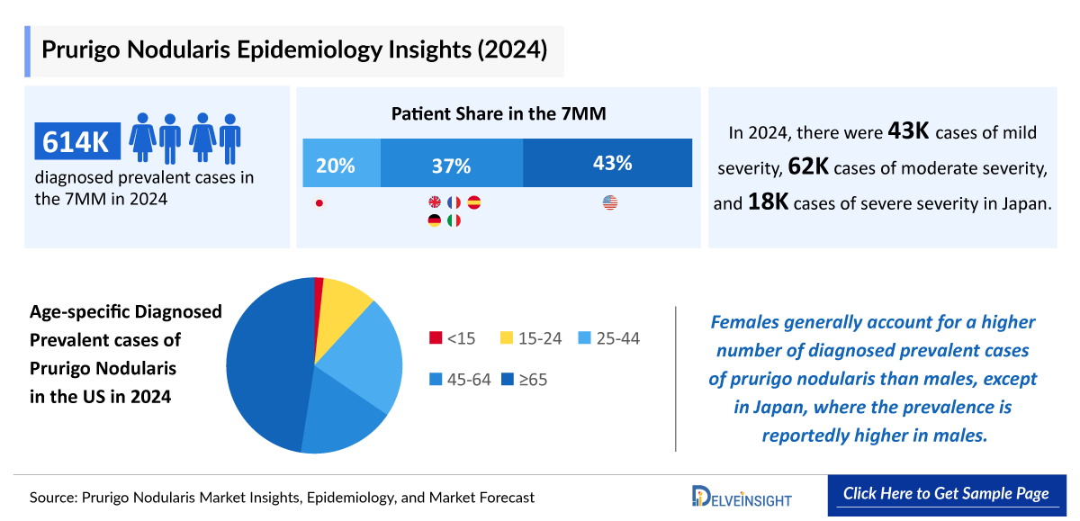 Prurigo Nodularis Epidemiology Insight