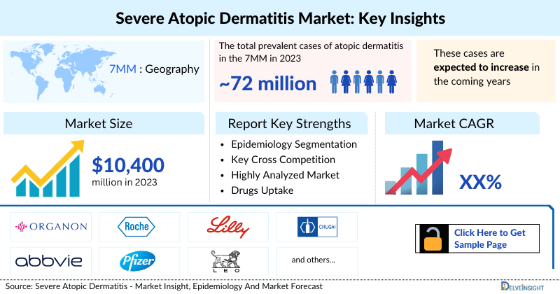 Severe Atopic Dermatitis Market