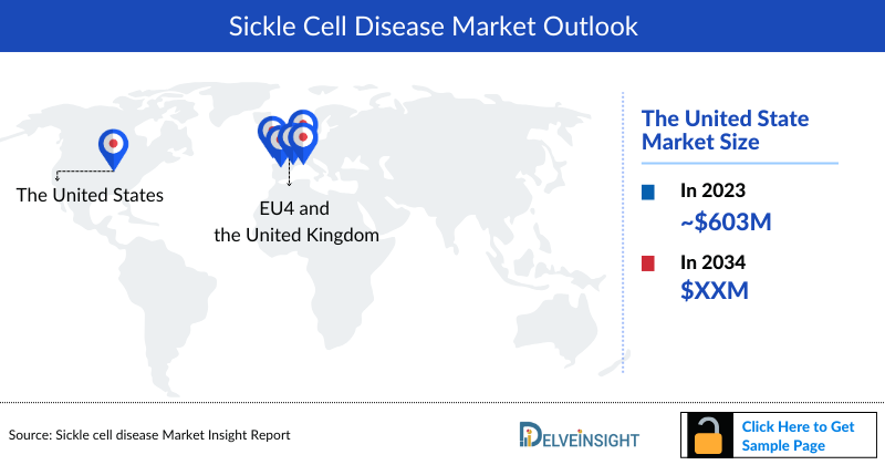 Sickle Cell Disease Market Outlook