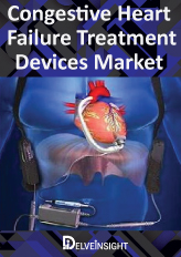 Image Guided Surgery Devices - Market Insights, Competitive Landscape and Market Forecast-2026