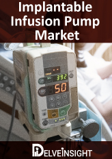 Implantable Infusion Pumps Market Insights, Competitive Landscape and Market Forecast–2026