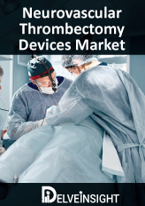Neurovascular Thrombectomy Devices Market Insights, Competitive Landscape and Market Forecast–2026