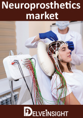 Neuroprosthetics Market Insights, Competitive Landscape and Market Forecast–2026