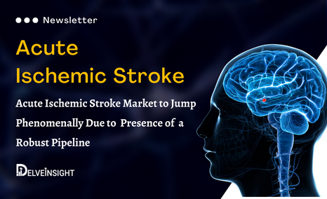Acute Ischemic Stroke Newsletter