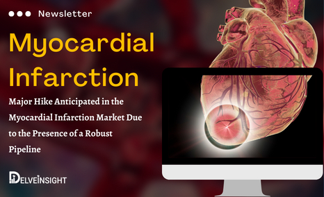 Myocardial Infarction Newsletter