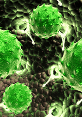 Diffuse Large B-cell Lymphoma - Market Insight, Epidemiology And Market Forecast - 2032