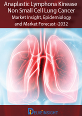 Anaplastic lymphoma kinase Non-Small Cell Lung Cancer (ALK-NSCLC)-Market Insights, Epidemiology and Market Forecast—2032