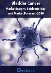 Bladder cancer- Market Insight, Epidemiology and Market Forecast -2030
