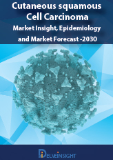 Cutaneous Squamous cell Carcinoma (CsCC)- Market Insight, Epidemiology and Market Forecast -2030