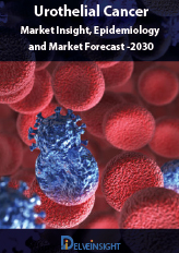 Urothelial Carcinoma- Market Insight, Epidemiology and Market Forecast -2030