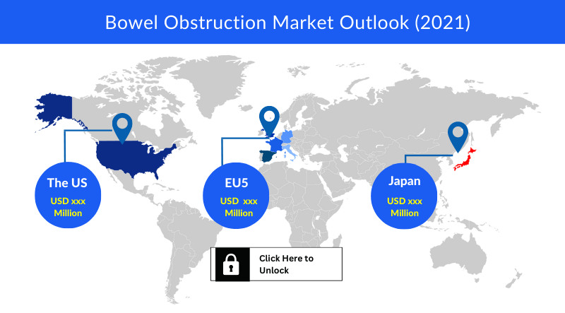 Bowel Obstruction Market